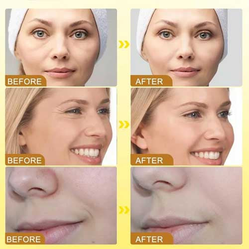 Botox Bee Venom Cream – Anti Aging Wrinkle Remover & Skin Tightening Moisturizer (20g)